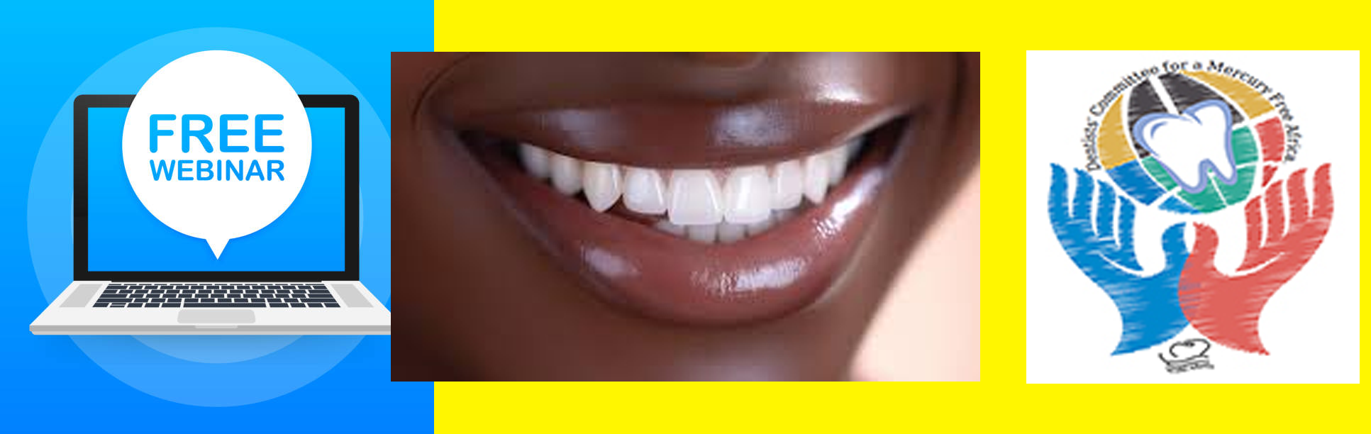 Mercury Free Webinar